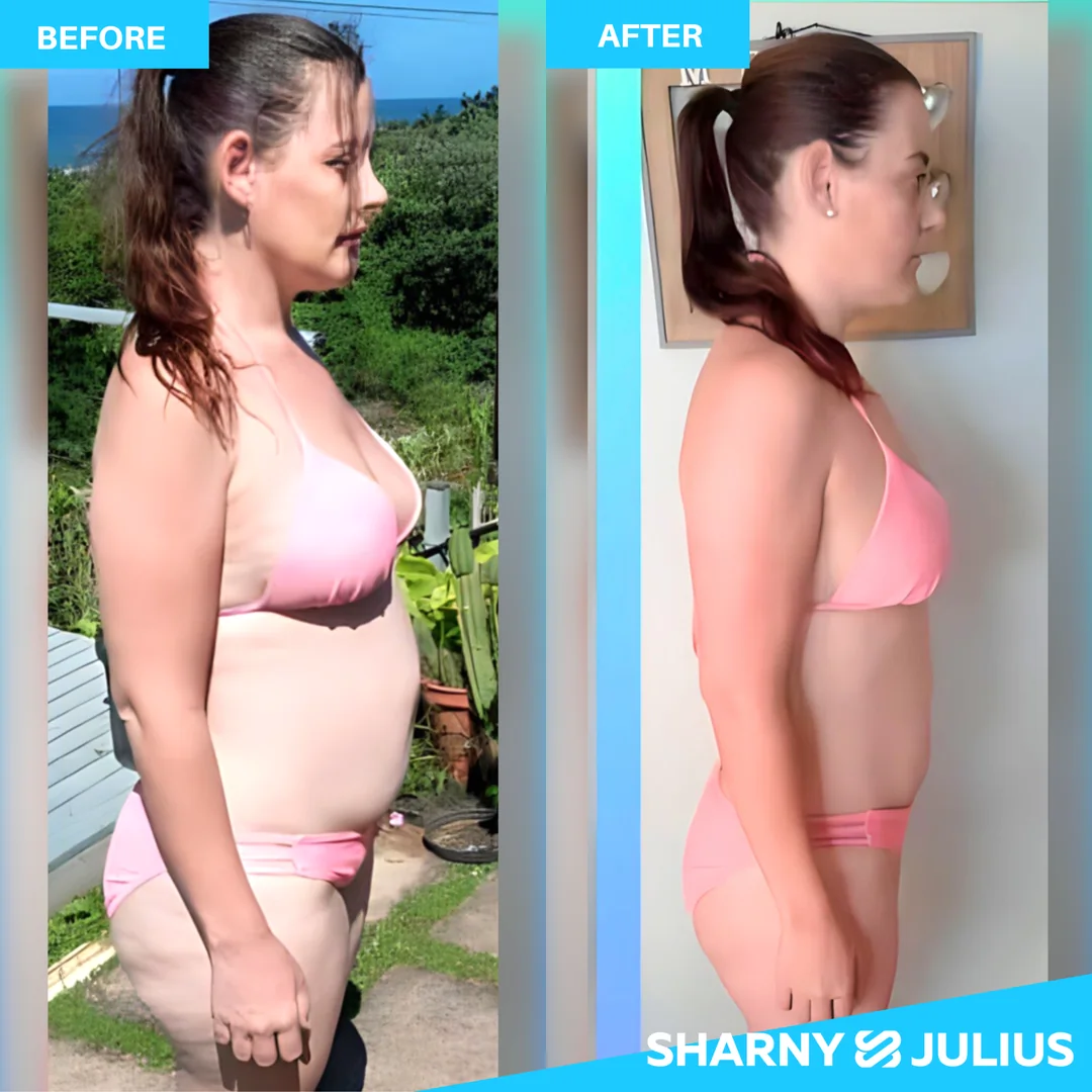 Chantel — SCPF before and after transformation