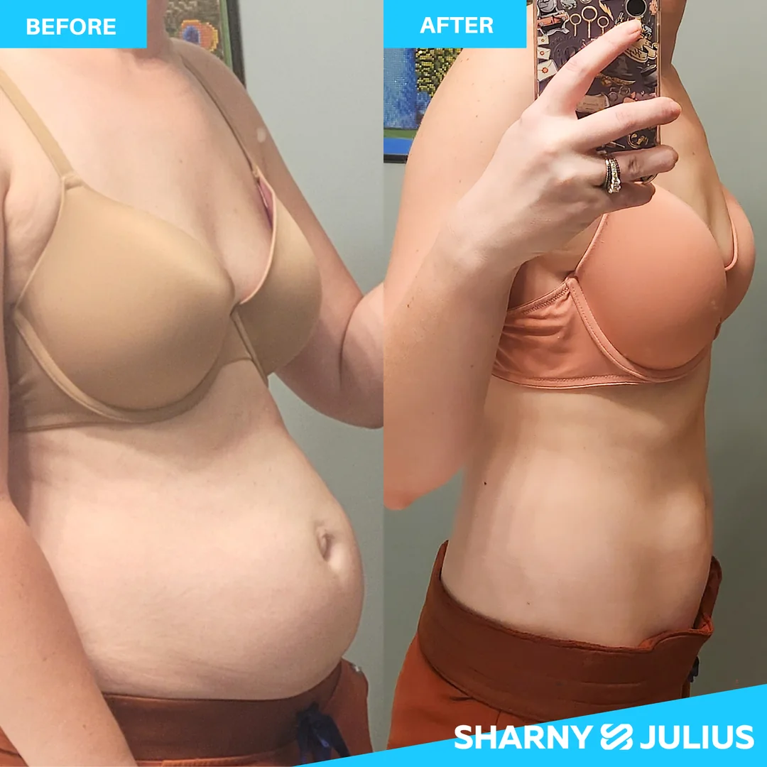 Jessica Butcher — SCPF before and after transformation