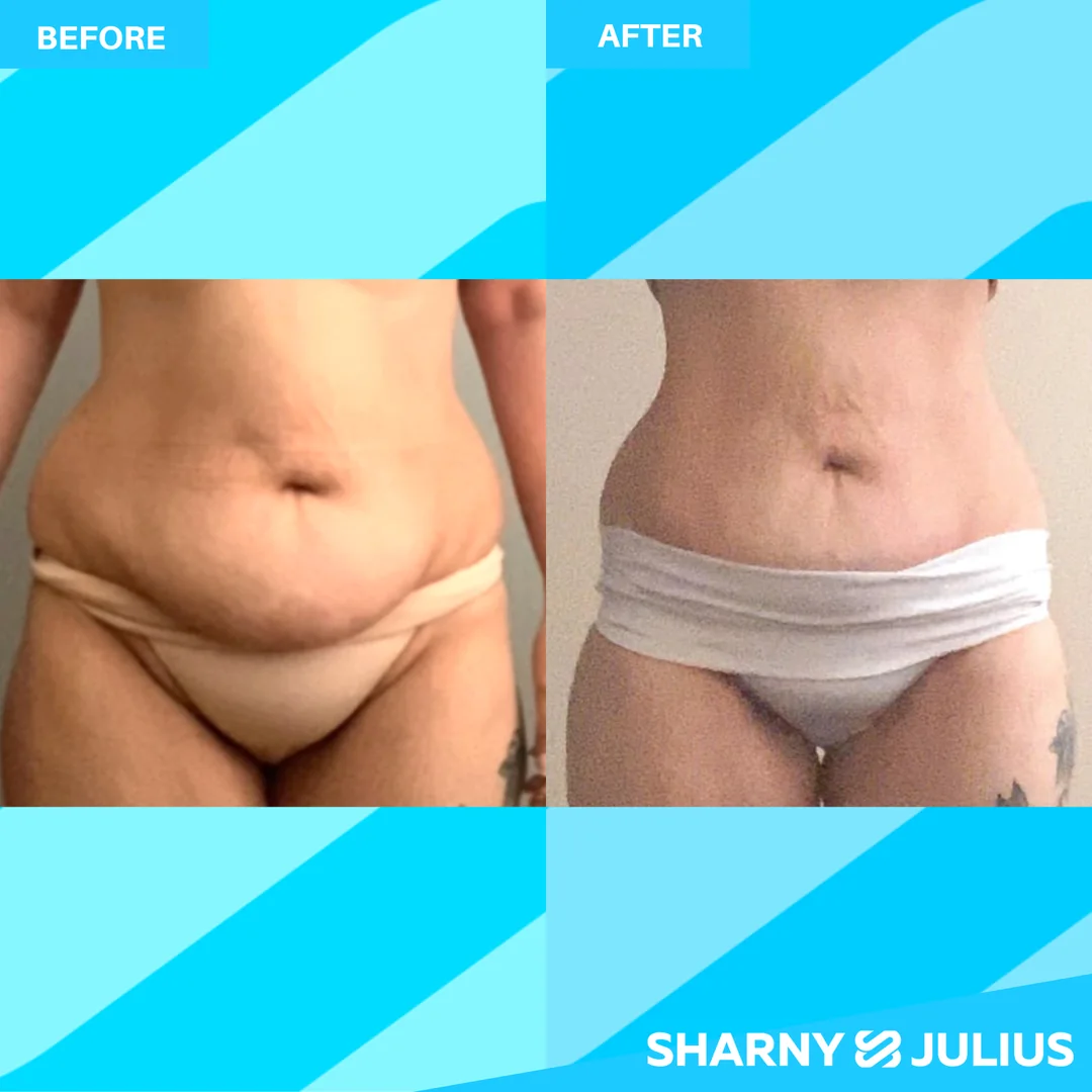 Kristy Mulcahey — SCPF before and after transformation