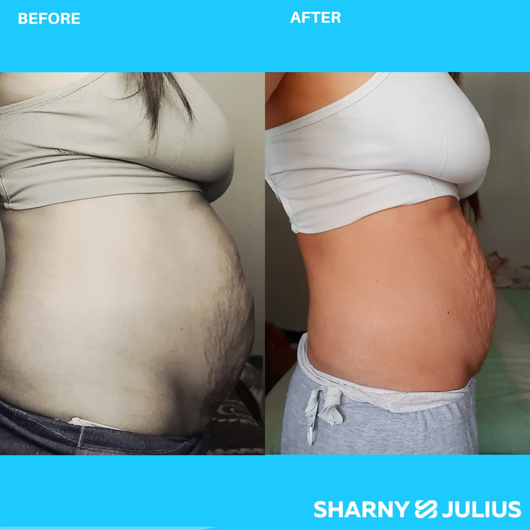 Maria Jones — SCPF before and after transformation