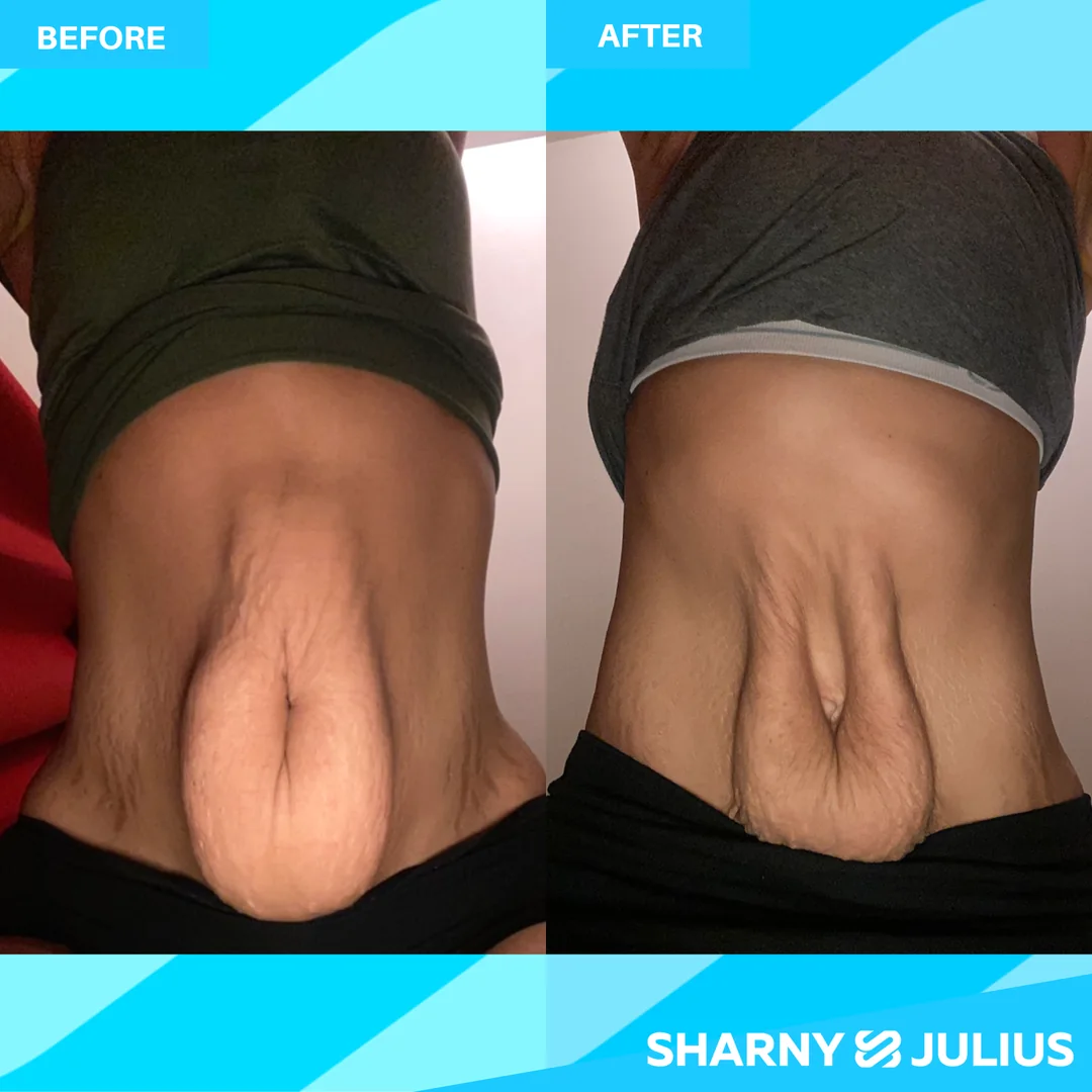 Shirreene Smith — SCPF before and after transformation
