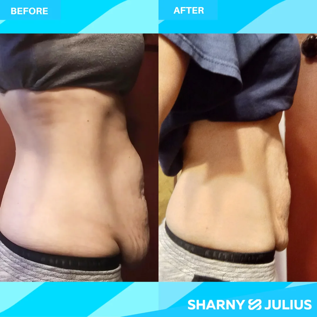 Stephanie Fongers — SCPF before and after transformation